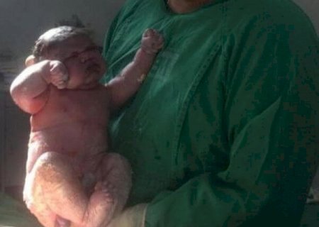 Bebê gigante nasce com 6 kg e 45g em Maracaju