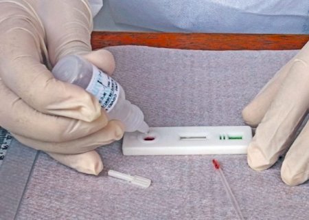 SES confirma 1,4 mil novos casos e 18 mortes por Covid no Estado