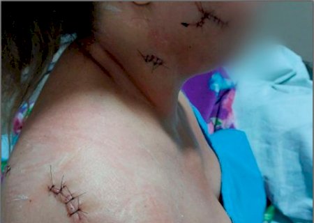 Justi&ccedil;a nega indeniza&ccedil;&atilde;o a motorista esfaqueada 15 vezes por passageiro