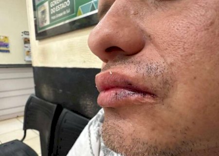 Motorista tem carro roubado e acaba espancado na porta de casa