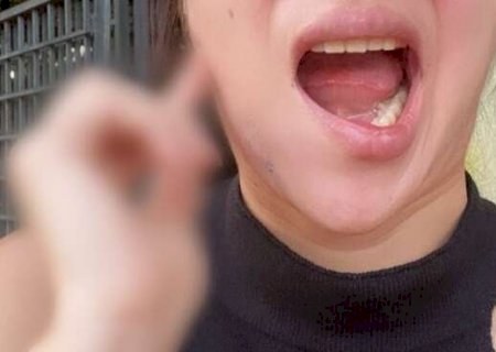Nem fisioterapia resolveu sequelas de procedimento feito por dentista famosa