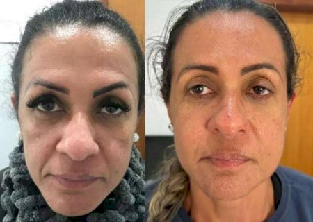 Cl&iacute;nica Corpo & Pele resgata a juventude com protocolo inovador