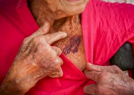 MS lidera casos de viol&ecirc;ncia contra idosos dentro da fam&iacute;lia e entre conhecidos