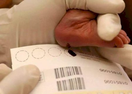 Minist&eacute;rio da Sa&uacute;de aumenta em 30% recursos para teste do pezinho