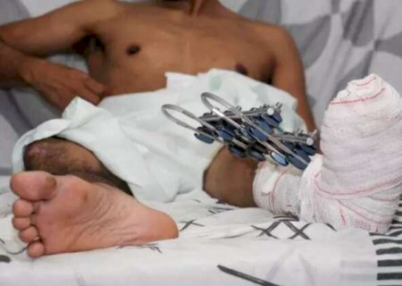Amputa&ccedil;&atilde;o, viuvez e espera por per&iacute;cia h&aacute; 6 meses: o calv&aacute;rio de Jo&atilde;o em MS