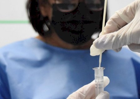 RJ: cenário epidemiológico de covid-19 tem tendência de redução