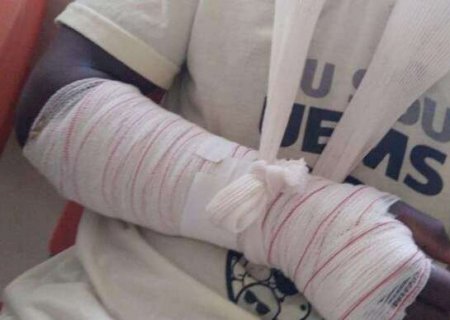 Motociclista &eacute; indenizado em R$ 10 mil ap&oacute;s cair em buraco aberto no asfalto