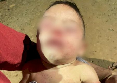 Mãe sai para trabalhar e pai espanca bebê de apenas 4 meses na Capital