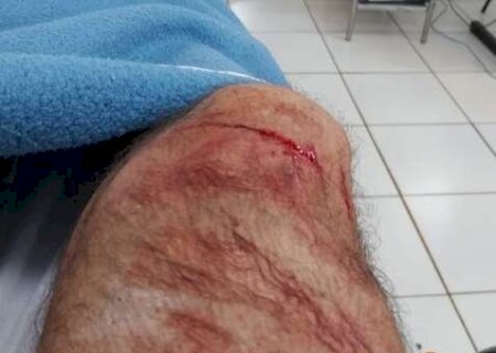 Ciclista cai ao passar por ciclovia bloqueada por passarela elevada