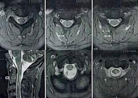 Aposentada descobre que seguro prometido de R$ 1 milh&atilde;o vale s&oacute; R$ 70 mil