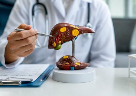 Sem dar sinais, hepatites podem passar anos causando danos ao f&iacute;gado