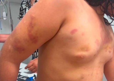 Padrasto &eacute; preso ap&oacute;s crian&ccedil;a de 6 anos dar entrada ferida em hospital