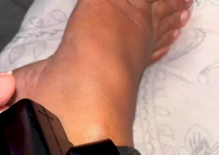 Médica é presa por engano em aeroporto e usa tornozeleira por 19 dias