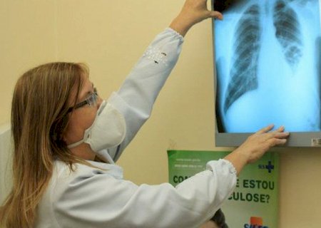 Diante do aumento de casos de tuberculose, prefeitura capacita equipes de saúde